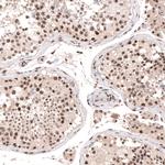 SETD2 Antibody in Immunohistochemistry (Paraffin) (IHC (P))