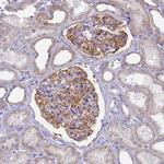 CD35 Antibody in Immunohistochemistry (Paraffin) (IHC (P))
