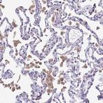 CD35 Antibody in Immunohistochemistry (Paraffin) (IHC (P))