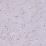 CD35 Antibody in Immunohistochemistry (Paraffin) (IHC (P))