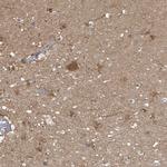 PGAM1 Antibody in Immunohistochemistry (Paraffin) (IHC (P))