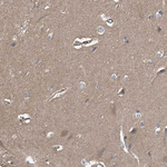 PGAM1 Antibody in Immunohistochemistry (Paraffin) (IHC (P))