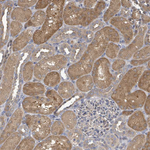 PGAM1 Antibody in Immunohistochemistry (Paraffin) (IHC (P))