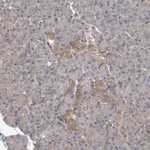 PGAM1 Antibody in Immunohistochemistry (Paraffin) (IHC (P))