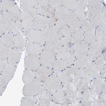 PGAM1 Antibody in Immunohistochemistry (Paraffin) (IHC (P))