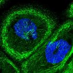 Septin-9 Polyclonal Antibody