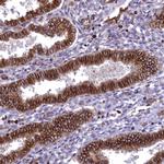 Septin-9 Antibody in Immunohistochemistry (Paraffin) (IHC (P))