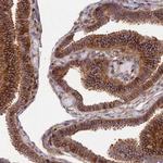 Septin-9 Antibody in Immunohistochemistry (Paraffin) (IHC (P))