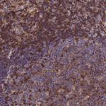 Septin-9 Antibody in Immunohistochemistry (Paraffin) (IHC (P))