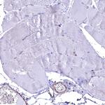 Septin-9 Antibody in Immunohistochemistry (Paraffin) (IHC (P))