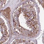Septin-9 Antibody in Immunohistochemistry (Paraffin) (IHC (P))