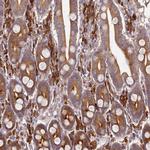 ORP2 Polyclonal Antibody