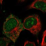 CRIP2 Polyclonal Antibody