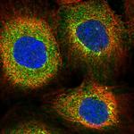 S100A3 Polyclonal Antibody