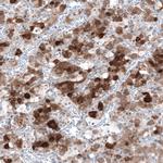 TSH beta Polyclonal Antibody