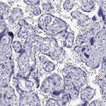 TSH beta Antibody in Immunohistochemistry (Paraffin) (IHC (P))
