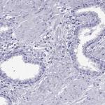 TSH beta Antibody in Immunohistochemistry (Paraffin) (IHC (P))