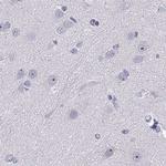 WFDC8 Antibody in Immunohistochemistry (Paraffin) (IHC (P))