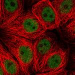 ZNF821 Polyclonal Antibody