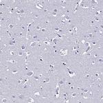 S100A11 Polyclonal Antibody