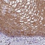 S100A11 Antibody in Immunohistochemistry (Paraffin) (IHC (P))