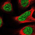 BRD2 Polyclonal Antibody