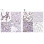 PADI4 Polyclonal Antibody