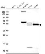 PADI4 Antibody in Western Blot (WB)