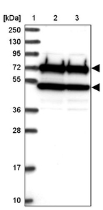 APC6 Antibody in Western Blot (WB)