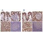 HSDL2 Antibody in Immunohistochemistry (Paraffin) (IHC (P))