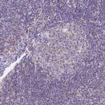 HSDL2 Antibody in Immunohistochemistry (Paraffin) (IHC (P))