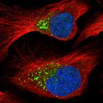 PCOLCE Polyclonal Antibody