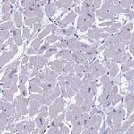 MYBPC2 Polyclonal Antibody