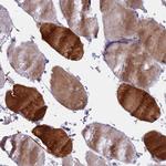 MYBPC2 Antibody in Immunohistochemistry (Paraffin) (IHC (P))