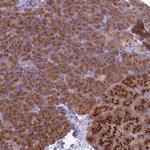APC1 Antibody in Immunohistochemistry (Paraffin) (IHC (P))