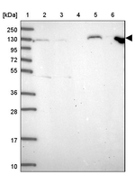 APC1 Antibody in Western Blot (WB)