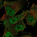 HuD Polyclonal Antibody