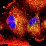 NBPF15 Polyclonal Antibody