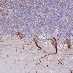 NBPF15 Antibody in Immunohistochemistry (Paraffin) (IHC (P))