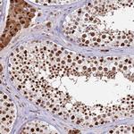 KPNA4 Antibody in Immunohistochemistry (Paraffin) (IHC (P))