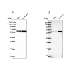 KPNA4 Antibody in Western Blot (WB)