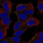 CARF Antibody in Immunocytochemistry (ICC/IF)