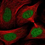 SMC3 Antibody in Immunocytochemistry (ICC/IF)