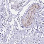 FAM72A Antibody in Immunohistochemistry (Paraffin) (IHC (P))