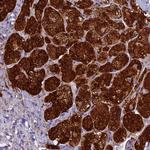 ECE2 Antibody in Immunohistochemistry (Paraffin) (IHC (P))