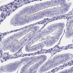 ECE2 Polyclonal Antibody