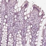 Calreticulin 3 Antibody in Immunohistochemistry (Paraffin) (IHC (P))