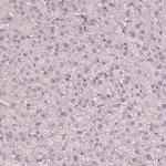 Calreticulin 3 Antibody in Immunohistochemistry (Paraffin) (IHC (P))