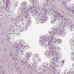 Calreticulin 3 Antibody in Immunohistochemistry (Paraffin) (IHC (P))