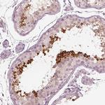 Calreticulin 3 Antibody in Immunohistochemistry (Paraffin) (IHC (P))